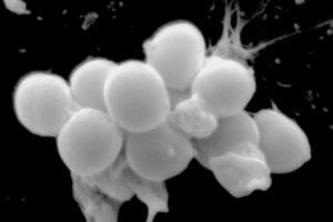 KISSMat: A new generation of anti-infective materials and coatings