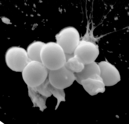 You are currently viewing KISSMat : Une nouvelle génération de matériaux et de revêtements anti-infectieux